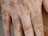 пưҽԺ
